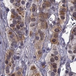 CHST8 Antibody, Novus Biologicals 25 &mu;L; Unlabeled:Antibodies, Polyclonal
